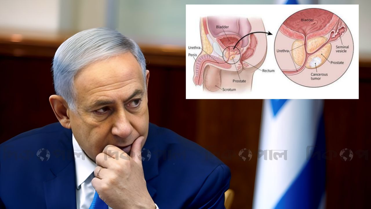 মরণব্যাধি প্রোস্টেট ক্যান্সারে আক্রান্ত নেতানিয়াহু—বিশ্বজুড়ে চাঞ্চল্য!